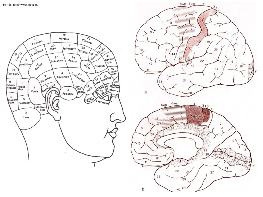 Aphasia