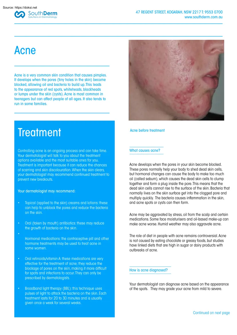 Acne, SouthDerm