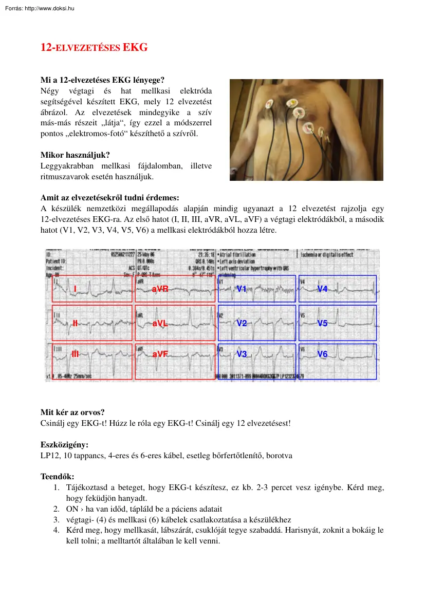 12 elvezetéses EKG