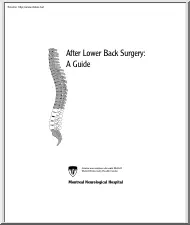 After Lower Back Surgery, A Guide