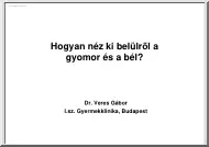 Dr. Veres Gábor - Hogyan néz ki belülről a gyomor és a bél