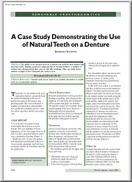 Barbara Swistak - A case study demonstrating the use of natural teeth on a denture