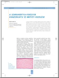 dr. Módis László - A szaruhártya-fekélyek konzervatív és műtéti kezelése
